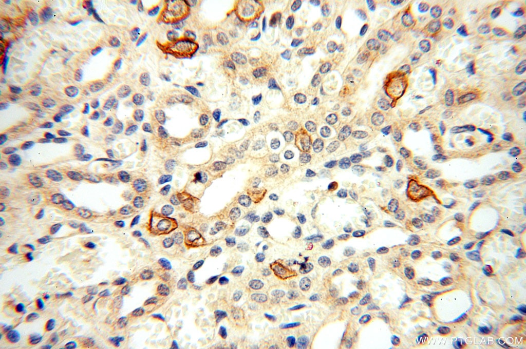 IHC staining of human kidney using 17058-1-AP