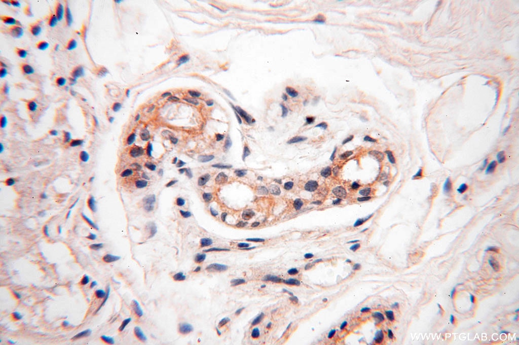 Immunohistochemistry (IHC) staining of human skin tissue using TEKT4 Polyclonal antibody (17058-1-AP)