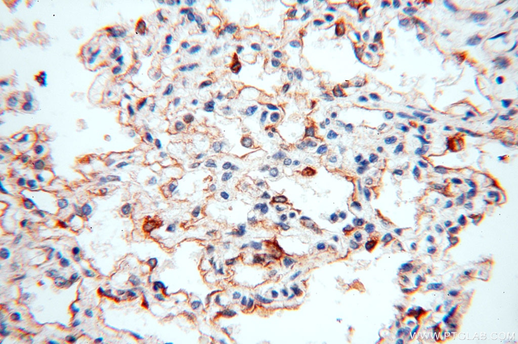 Immunohistochemistry (IHC) staining of human lung tissue using TEKT4 Polyclonal antibody (17058-1-AP)