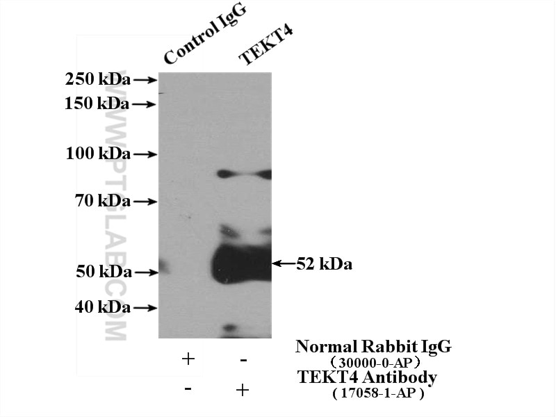 Immunoprecipitation (IP) experiment of HeLa cells using TEKT4 Polyclonal antibody (17058-1-AP)