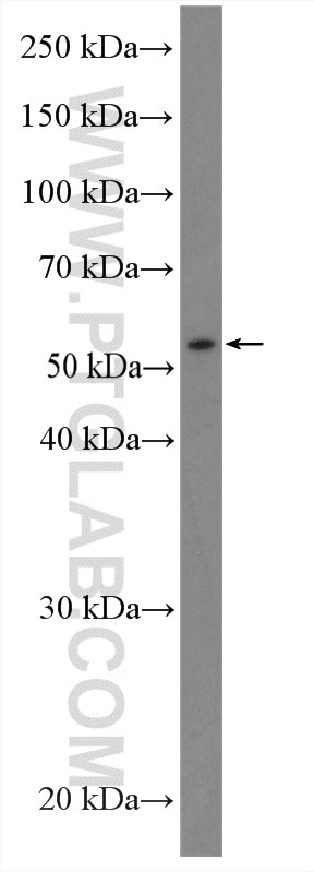 Western Blot (WB) analysis of MDA-MB-453s cells using TEKT4 Polyclonal antibody (17058-1-AP)