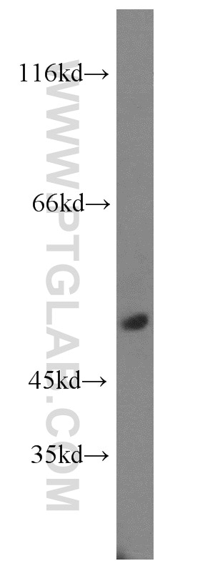 Western Blot (WB) analysis of human testis tissue using TEKT4 Polyclonal antibody (17058-1-AP)