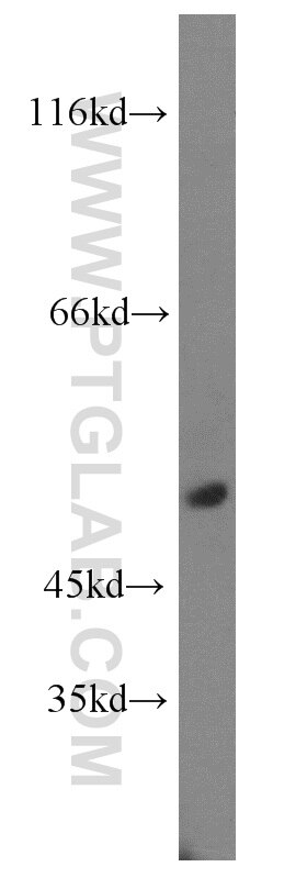 Western Blot (WB) analysis of human testis tissue using TEKT4 Polyclonal antibody (17058-1-AP)