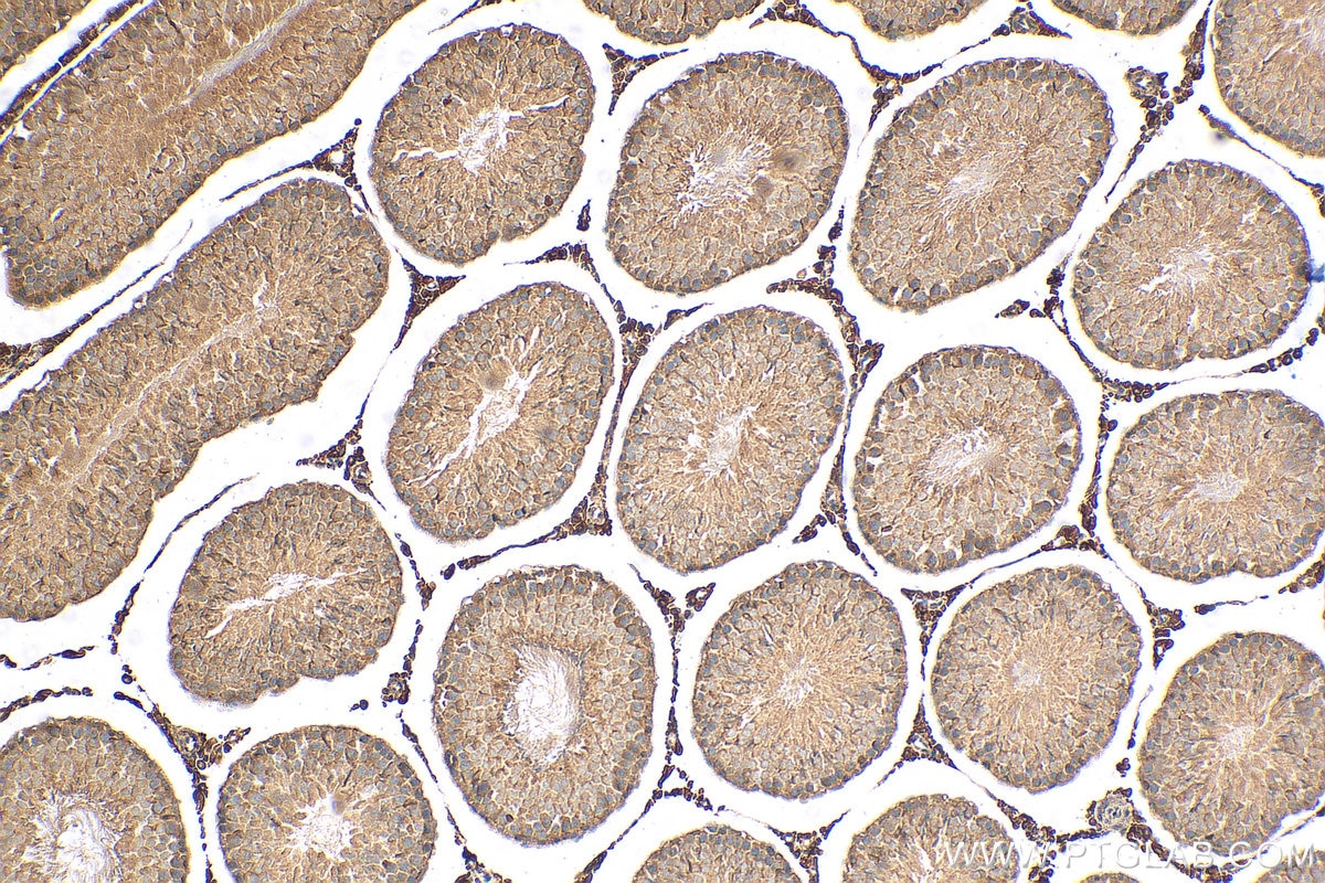 Immunohistochemistry (IHC) staining of rat testis tissue using TEKT5 Polyclonal antibody (26108-1-AP)