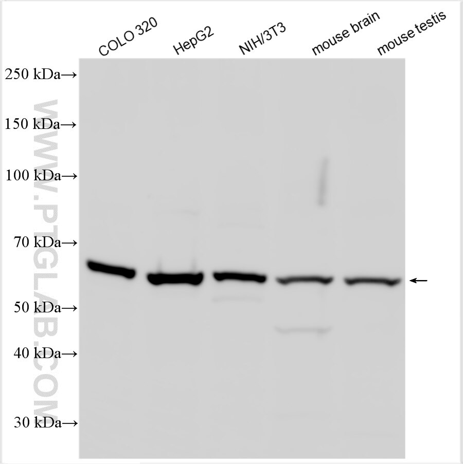 Western Blot (WB) analysis of various lysates using TEKT5 Polyclonal antibody (26108-1-AP)