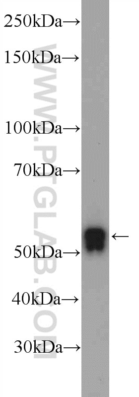 Western Blot (WB) analysis of HepG2 cells using TEKT5 Polyclonal antibody (26108-1-AP)