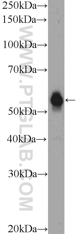 Western Blot (WB) analysis of COLO 320 cells using TEKT5 Polyclonal antibody (26108-1-AP)