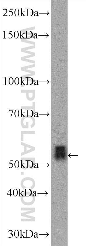 Western Blot (WB) analysis of mouse brain tissue using TEKT5 Polyclonal antibody (26108-1-AP)