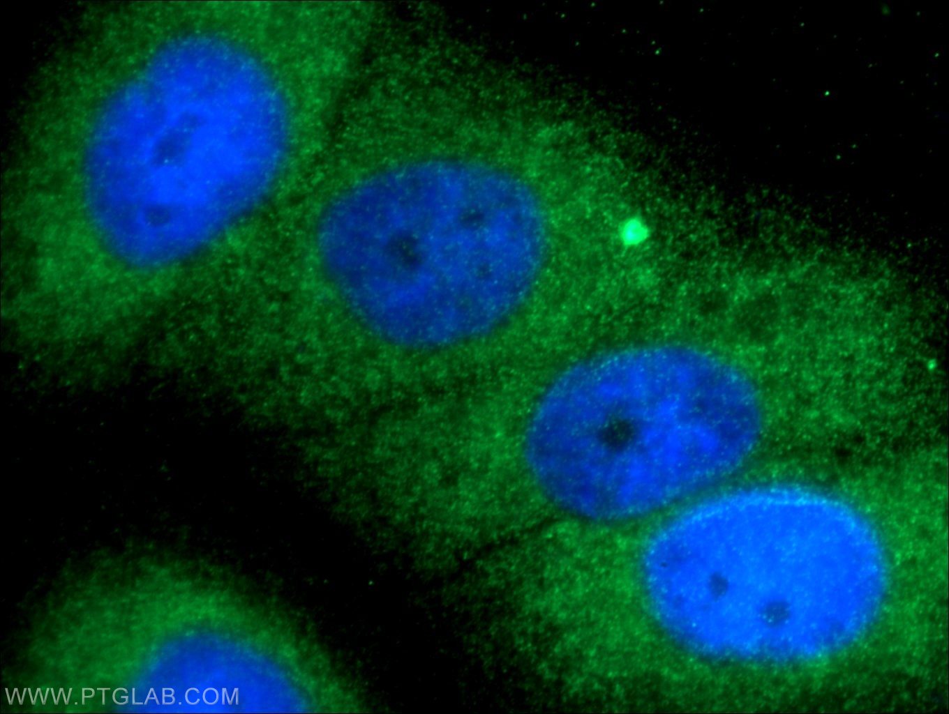 Immunofluorescence (IF) / fluorescent staining of HepG2 cells using TELO2 Polyclonal antibody (15975-1-AP)