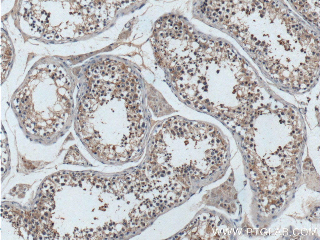 Immunohistochemistry (IHC) staining of human testis tissue using TELO2 Polyclonal antibody (15975-1-AP)