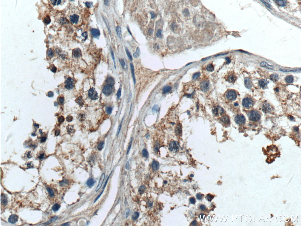 Immunohistochemistry (IHC) staining of human testis tissue using TELO2 Polyclonal antibody (15975-1-AP)