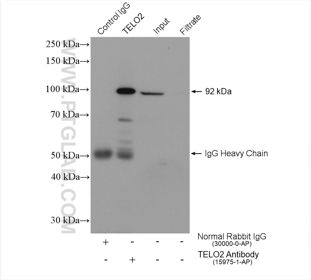 Immunoprecipitation (IP) experiment of A431 cells using TELO2 Polyclonal antibody (15975-1-AP)