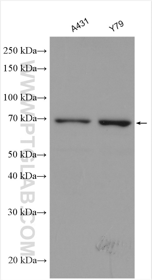 Western Blot (WB) analysis of various lysates using TELO2 Polyclonal antibody (15975-1-AP)
