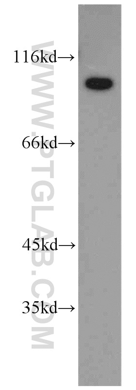 TELO2 Polyclonal antibody