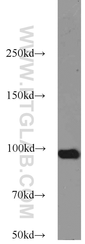 Western Blot (WB) analysis of A431 cells using TELO2 Polyclonal antibody (15975-1-AP)