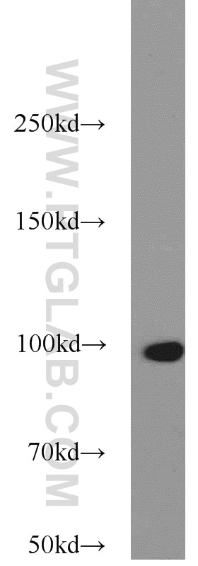 Western Blot (WB) analysis of Y79 cells using TELO2 Polyclonal antibody (15975-1-AP)