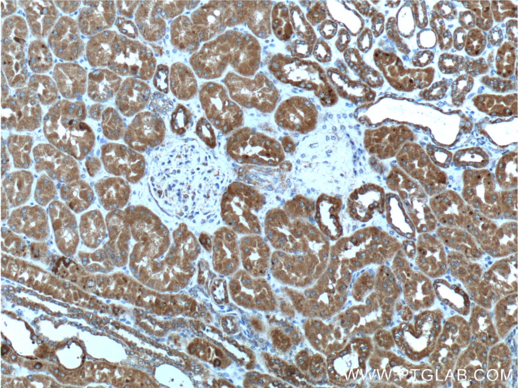 Immunohistochemistry (IHC) staining of human kidney tissue using TELO2 Monoclonal antibody (66077-1-Ig)