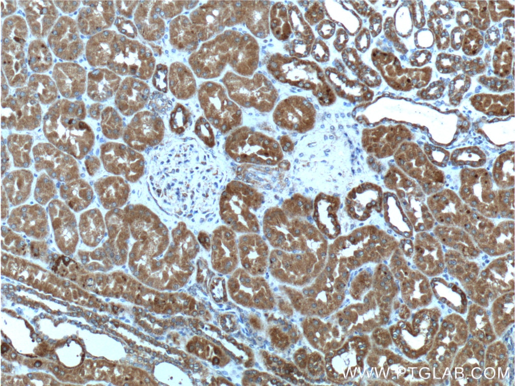 IHC staining of human kidney using 66077-1-Ig