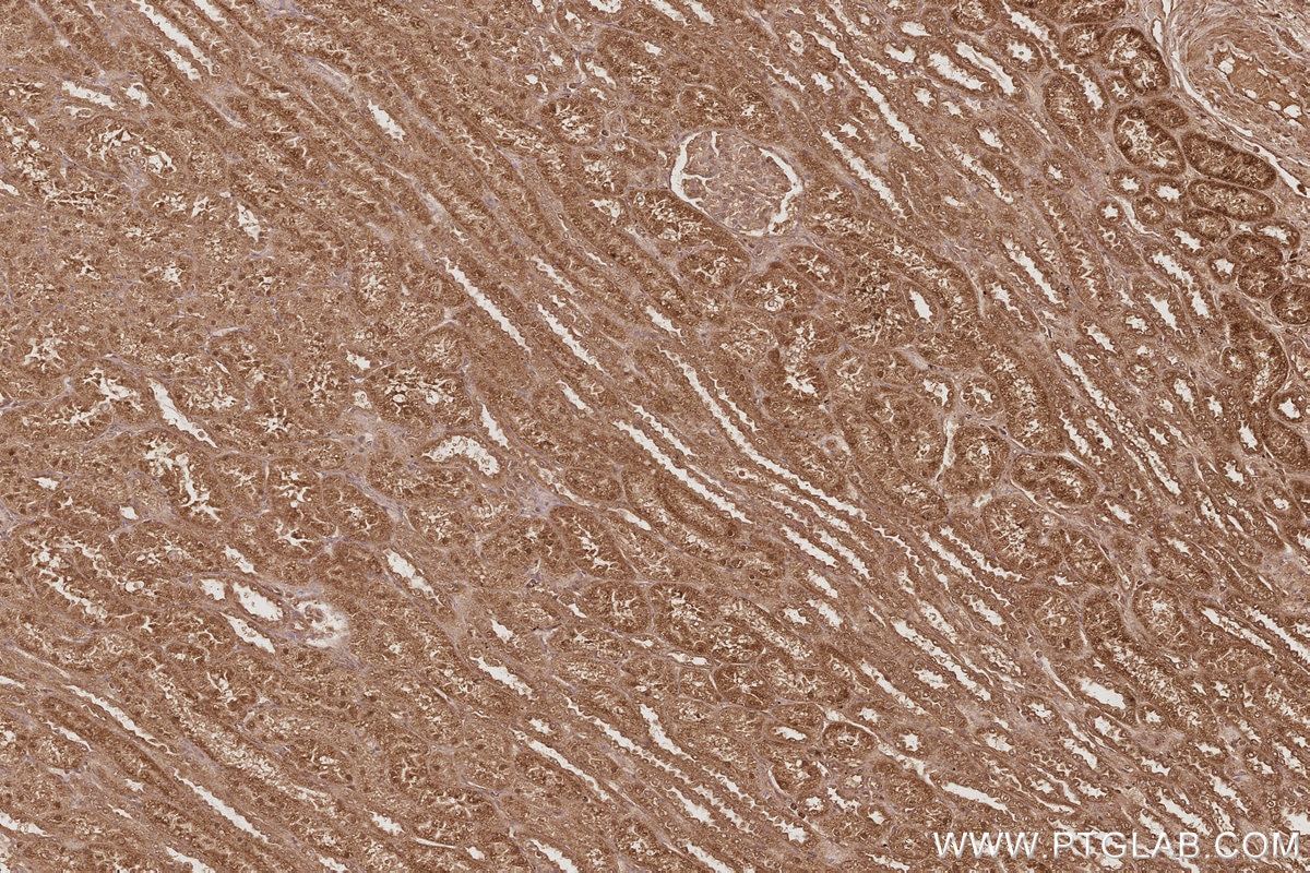 IHC staining of human kidney using 66077-1-Ig Immunohistochemistry (IHC) staining of human kidney tissue using TELO2 Monoclonal antibody (66077-1-Ig)
