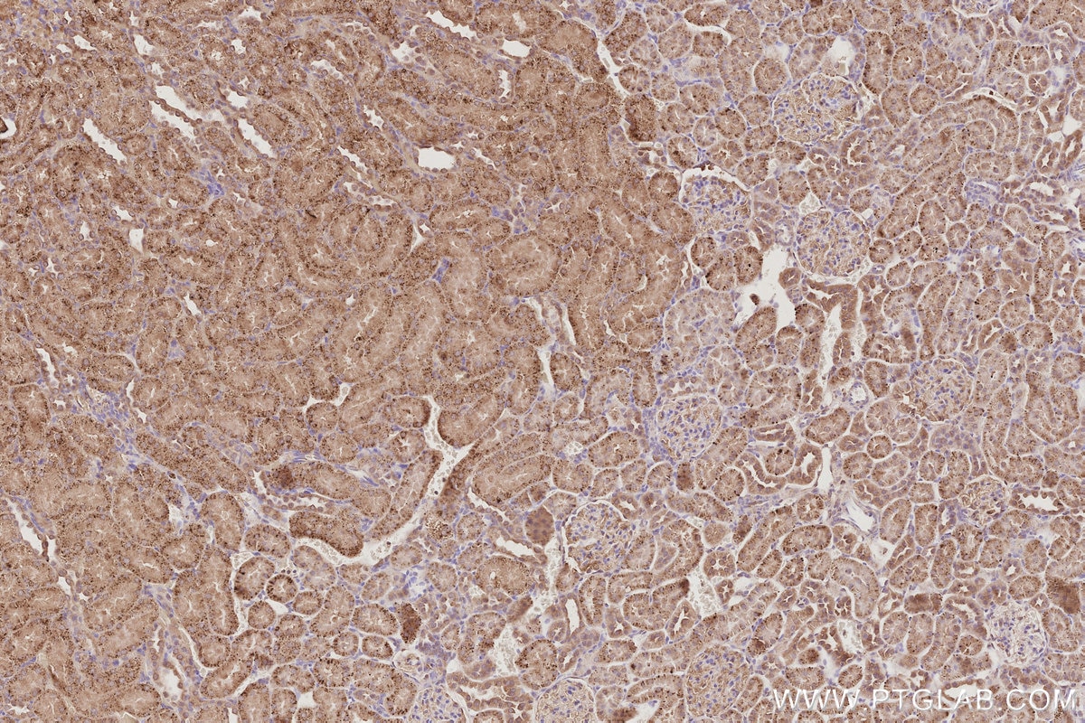 IHC staining of rat kidney using 66077-1-Ig Immunohistochemistry (IHC) staining of rat kidney tissue using TELO2 Monoclonal antibody (66077-1-Ig)