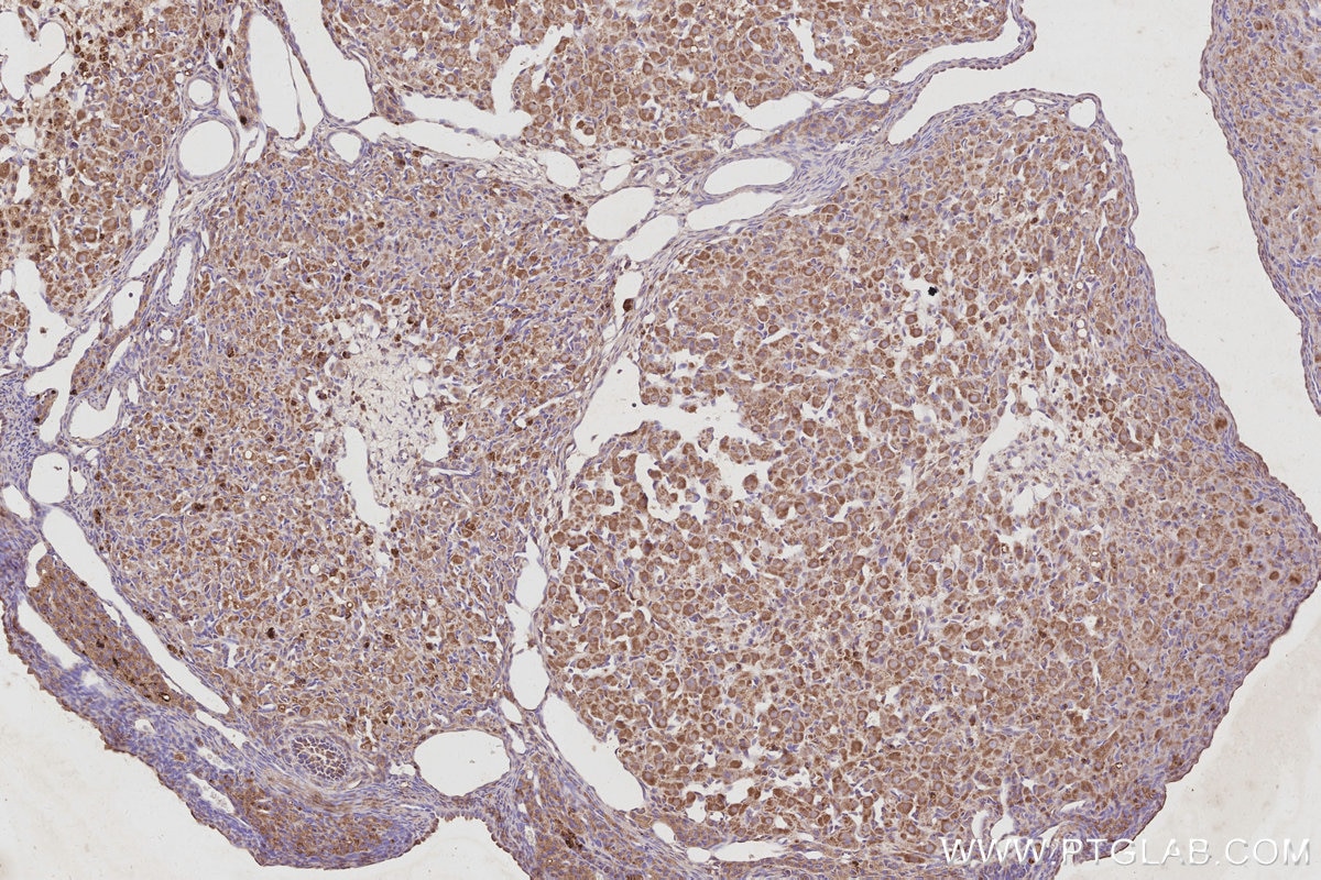 IHC staining of rat ovary using 66077-1-Ig Immunohistochemistry (IHC) staining of rat ovary tissue using TELO2 Monoclonal antibody (66077-1-Ig)