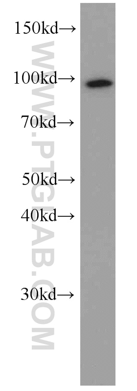 Western Blot (WB) analysis of A431 cells using TELO2 Monoclonal antibody (66077-1-Ig)