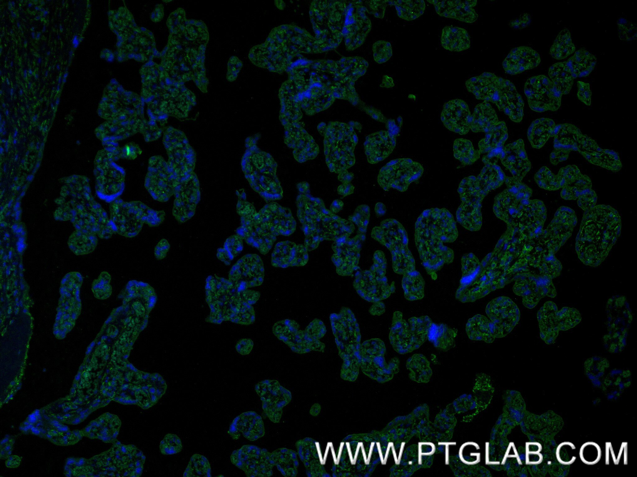 Immunofluorescence (IF) / fluorescent staining of human placenta tissue using TEM1 Recombinant monoclonal antibody (87247-1-RR)