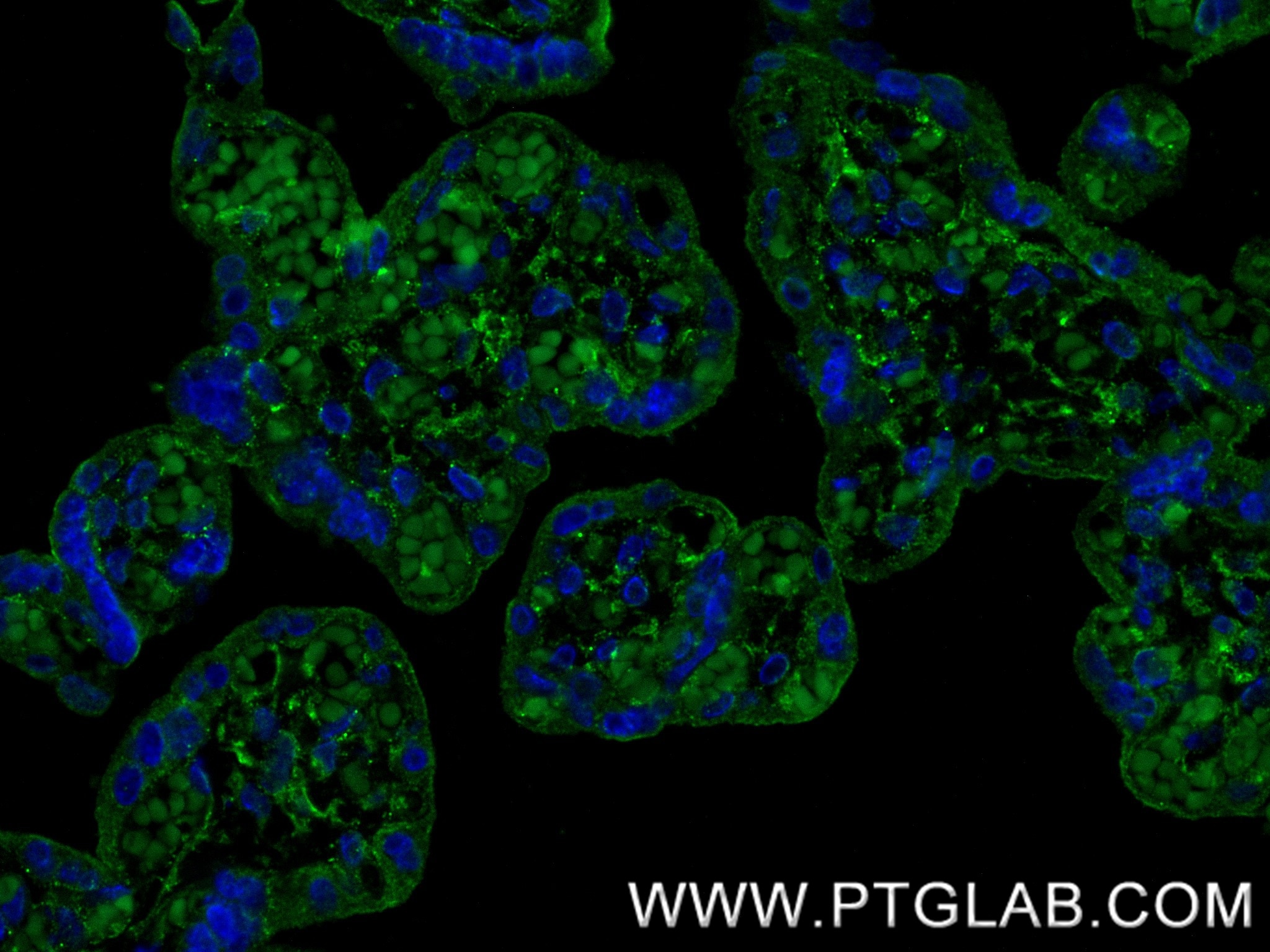 Immunofluorescence (IF) / fluorescent staining of human placenta tissue using TEM1 Recombinant monoclonal antibody (87247-1-RR)