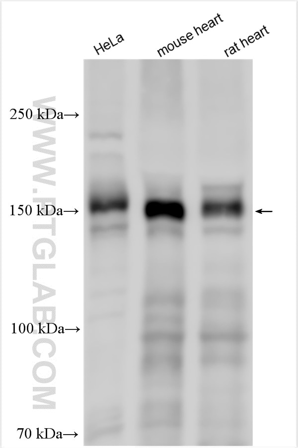 Western Blot (WB) analysis of various lysates using TENC1 Polyclonal antibody (28153-1-AP)