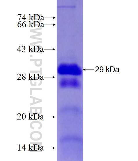 TENC1 fusion protein Ag27731 SDS-PAGE
