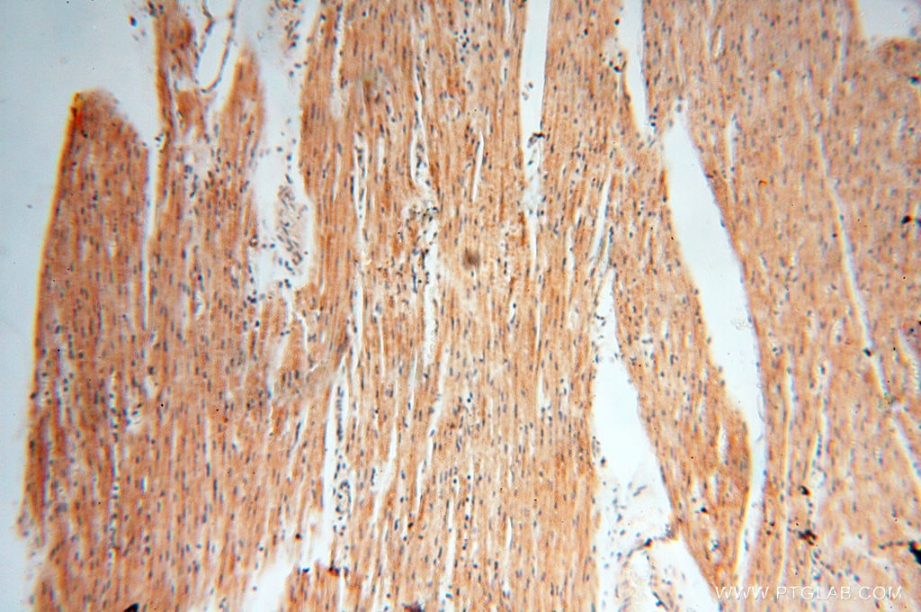 Immunohistochemistry (IHC) staining of human heart tissue using TERF1 Polyclonal antibody (11899-1-AP)