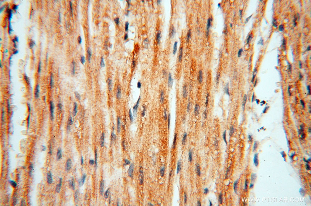 Immunohistochemistry (IHC) staining of human heart tissue using TERF1 Polyclonal antibody (11899-1-AP)