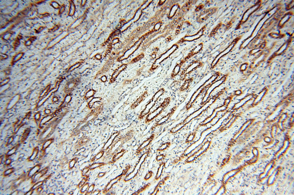 Immunohistochemistry (IHC) staining of human kidney tissue using TERF1 Polyclonal antibody (11899-1-AP)