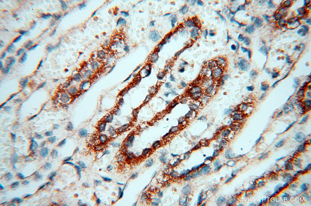 Immunohistochemistry (IHC) staining of human kidney tissue using TERF1 Polyclonal antibody (11899-1-AP)