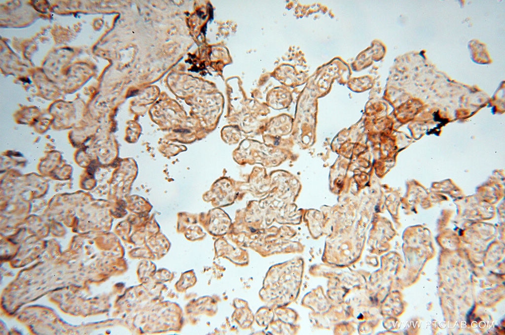 Immunohistochemistry (IHC) staining of human placenta tissue using TERF1 Polyclonal antibody (11899-1-AP)