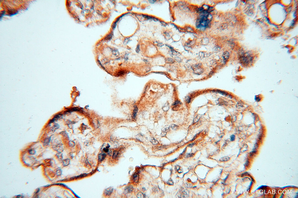 Immunohistochemistry (IHC) staining of human placenta tissue using TERF1 Polyclonal antibody (11899-1-AP)