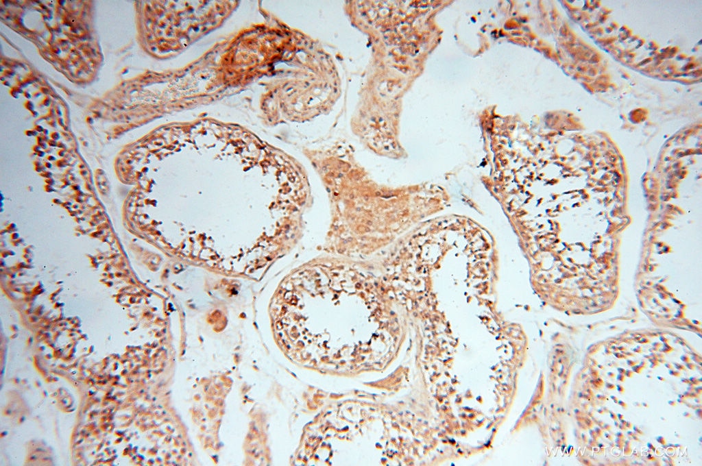 Immunohistochemistry (IHC) staining of human testis tissue using TERF1 Polyclonal antibody (11899-1-AP)