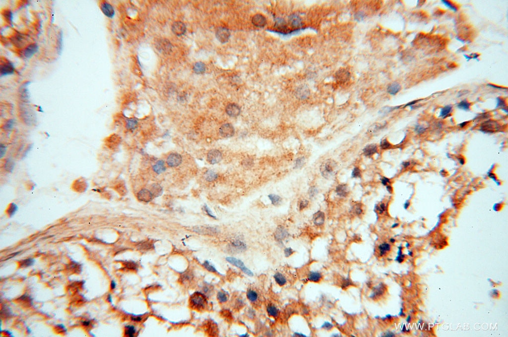 Immunohistochemistry (IHC) staining of human testis tissue using TERF1 Polyclonal antibody (11899-1-AP)