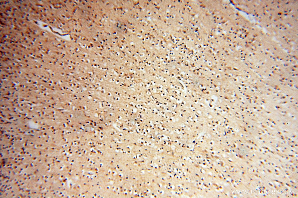 Immunohistochemistry (IHC) staining of human brain tissue using TERF1 Polyclonal antibody (11899-1-AP)