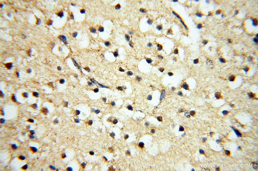 Immunohistochemistry (IHC) staining of human brain tissue using TERF1 Polyclonal antibody (11899-1-AP)