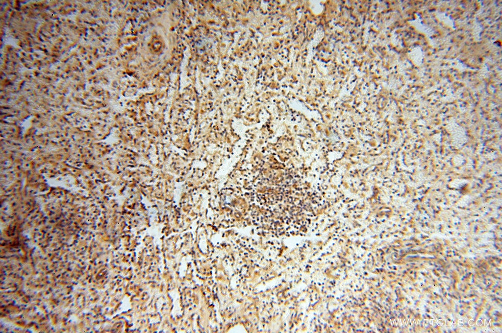 Immunohistochemistry (IHC) staining of human spleen tissue using TERF1 Polyclonal antibody (11899-1-AP)