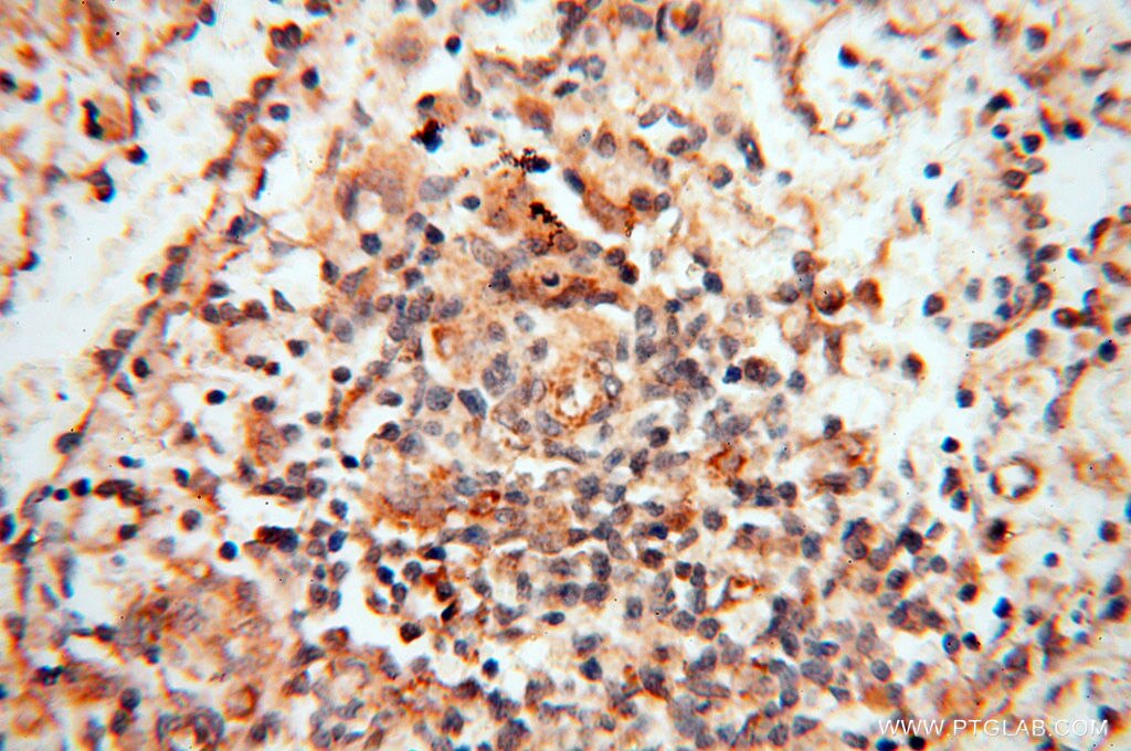 Immunohistochemistry (IHC) staining of human spleen tissue using TERF1 Polyclonal antibody (11899-1-AP)