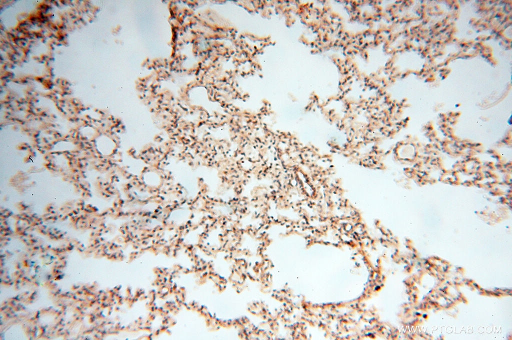 Immunohistochemistry (IHC) staining of human lung tissue using TERF1 Polyclonal antibody (11899-1-AP)