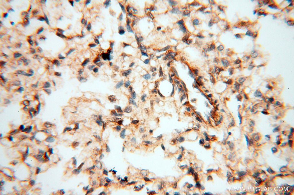 Immunohistochemistry (IHC) staining of human lung tissue using TERF1 Polyclonal antibody (11899-1-AP)