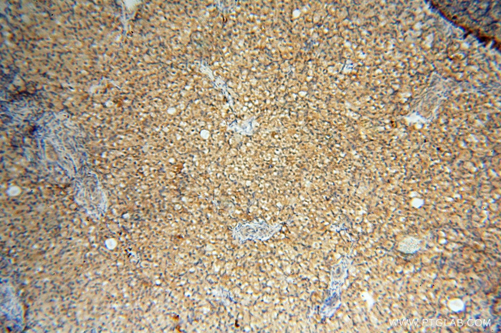 Immunohistochemistry (IHC) staining of human ovary tissue using TERF1 Polyclonal antibody (11899-1-AP)