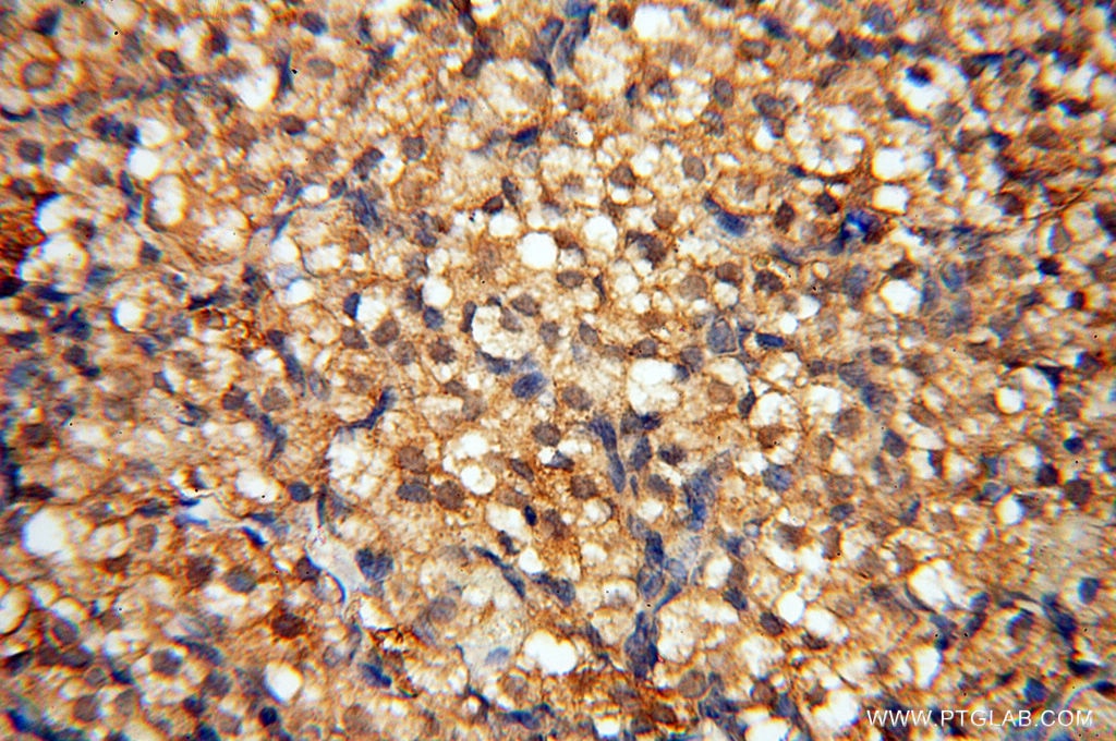 Immunohistochemistry (IHC) staining of human ovary tissue using TERF1 Polyclonal antibody (11899-1-AP)