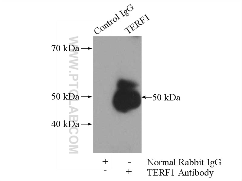 Immunoprecipitation (IP) experiment of HEK-293 cells using TERF1 Polyclonal antibody (11899-1-AP)
