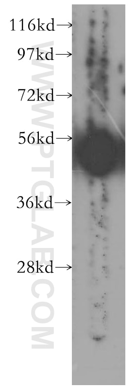Western Blot (WB) analysis of HEK-293 cells using TERF1 Polyclonal antibody (11899-1-AP)