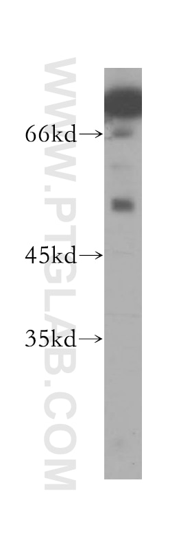 Western Blot (WB) analysis of HEK-293 cells using TERF1 Polyclonal antibody (11899-1-AP)