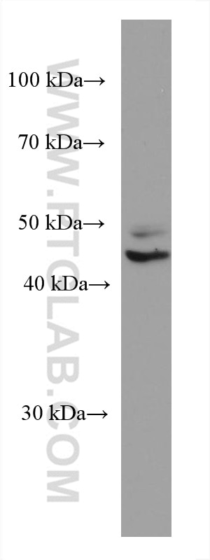 Western Blot (WB) analysis of HEK-293 cells using TERF1 Monoclonal antibody (67592-1-Ig)